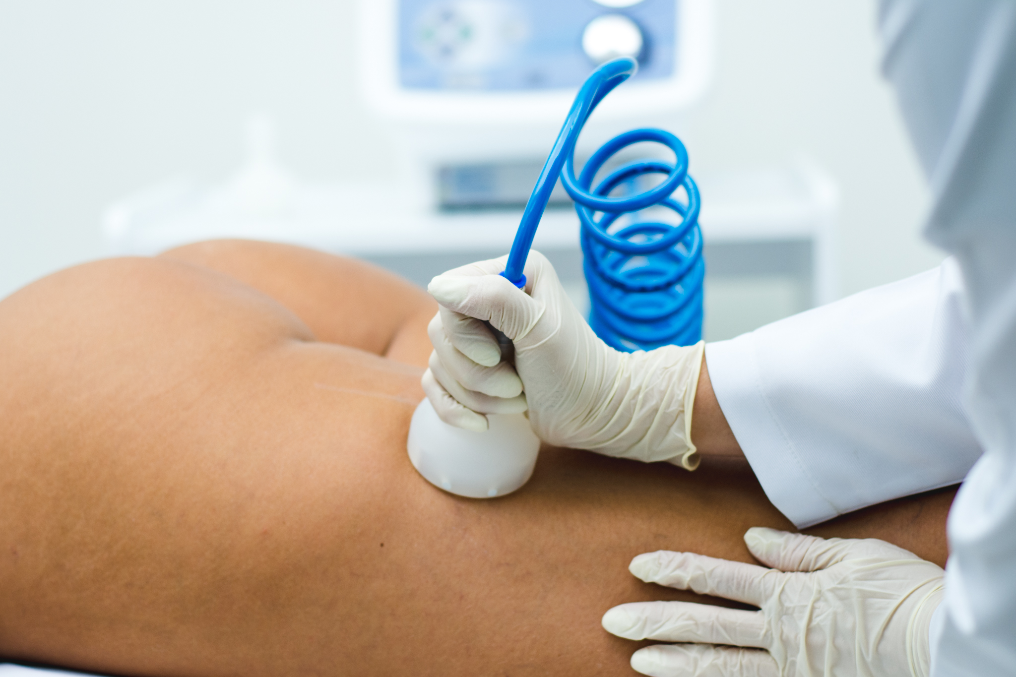 endermoterapia_posterior_de_coxa_celulite_dermotonus_slim_1